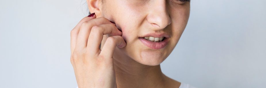 Quais são os sintomas de alergia no rosto? Saiba como cuidar
